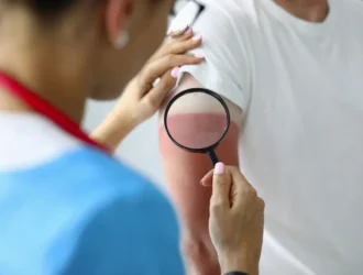 summer health problems and prevention