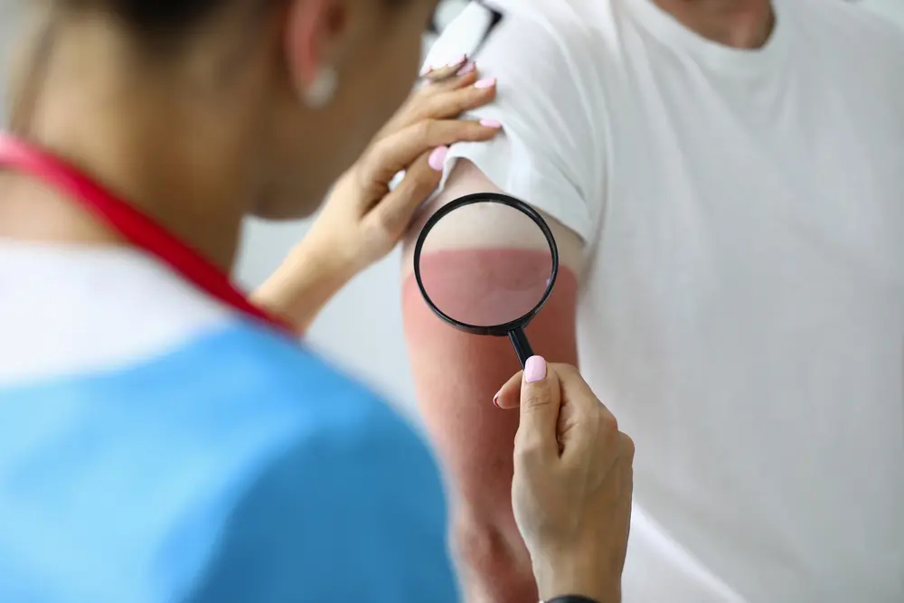 summer health problems and prevention