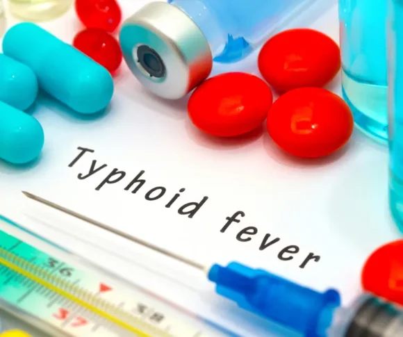 Typhoid Treatment