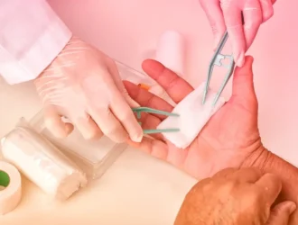 Wound Treatatment at Home