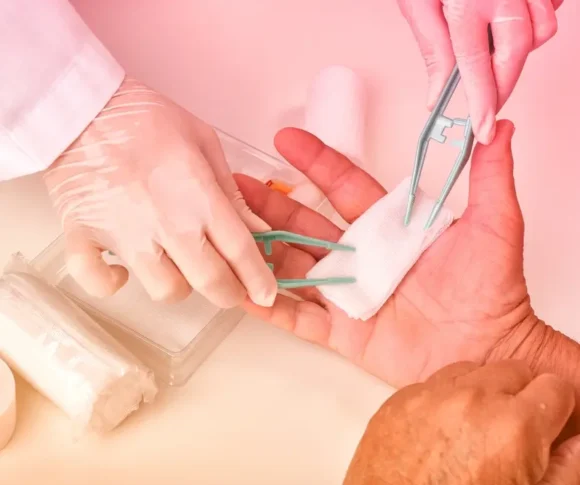 Wound Treatatment at Home